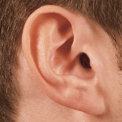 hearing-loss-img6