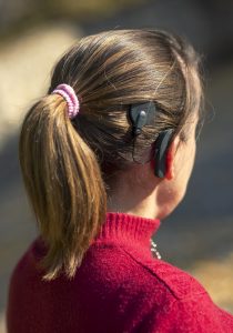 Woman head with cochleral implant hearing aid